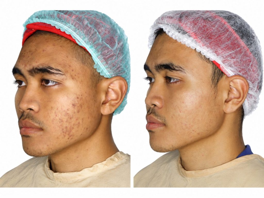 Exxoskin
