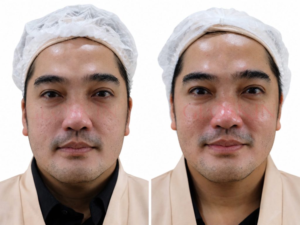 Luxury Facial Therapy