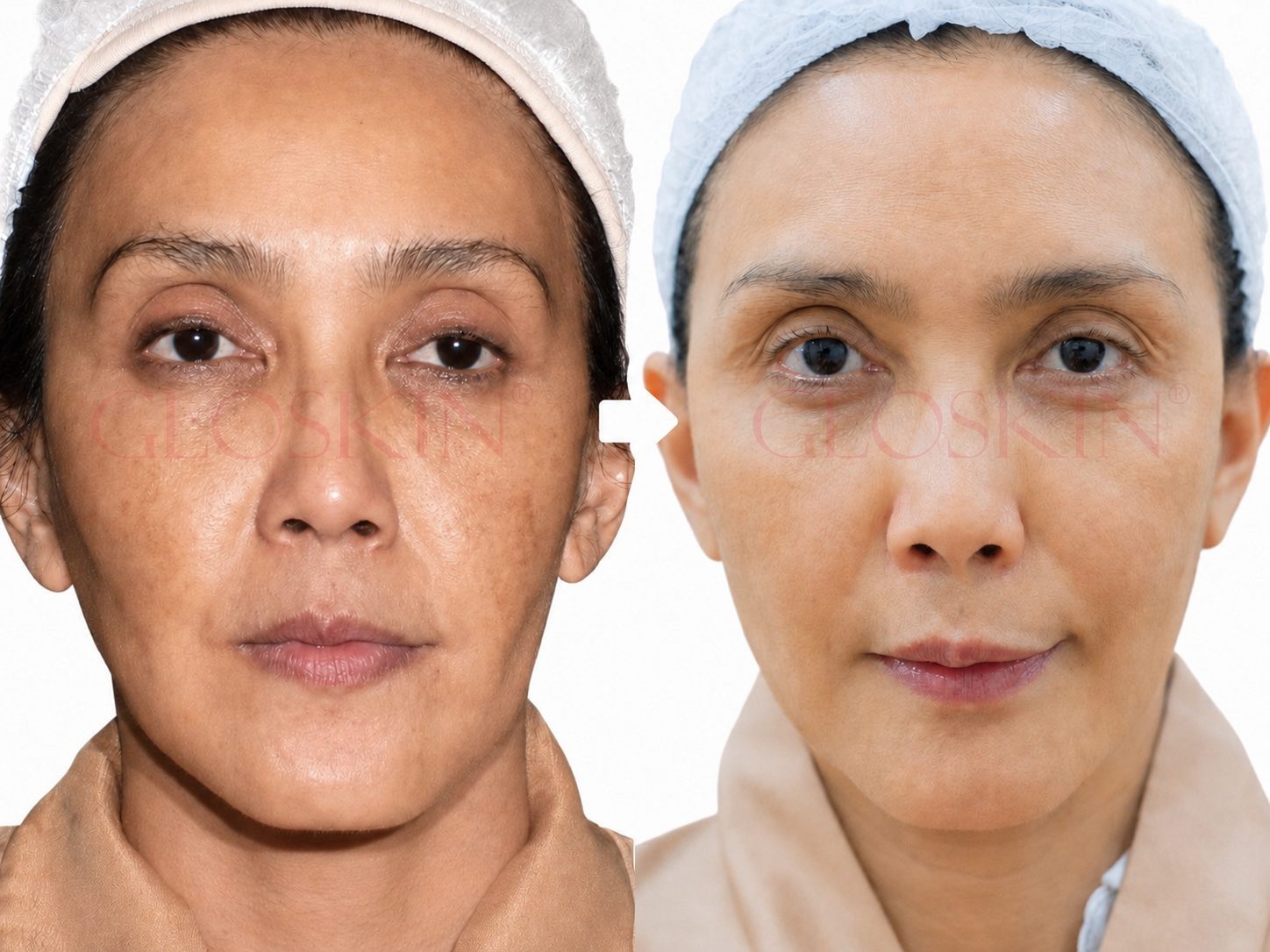 Skinvive